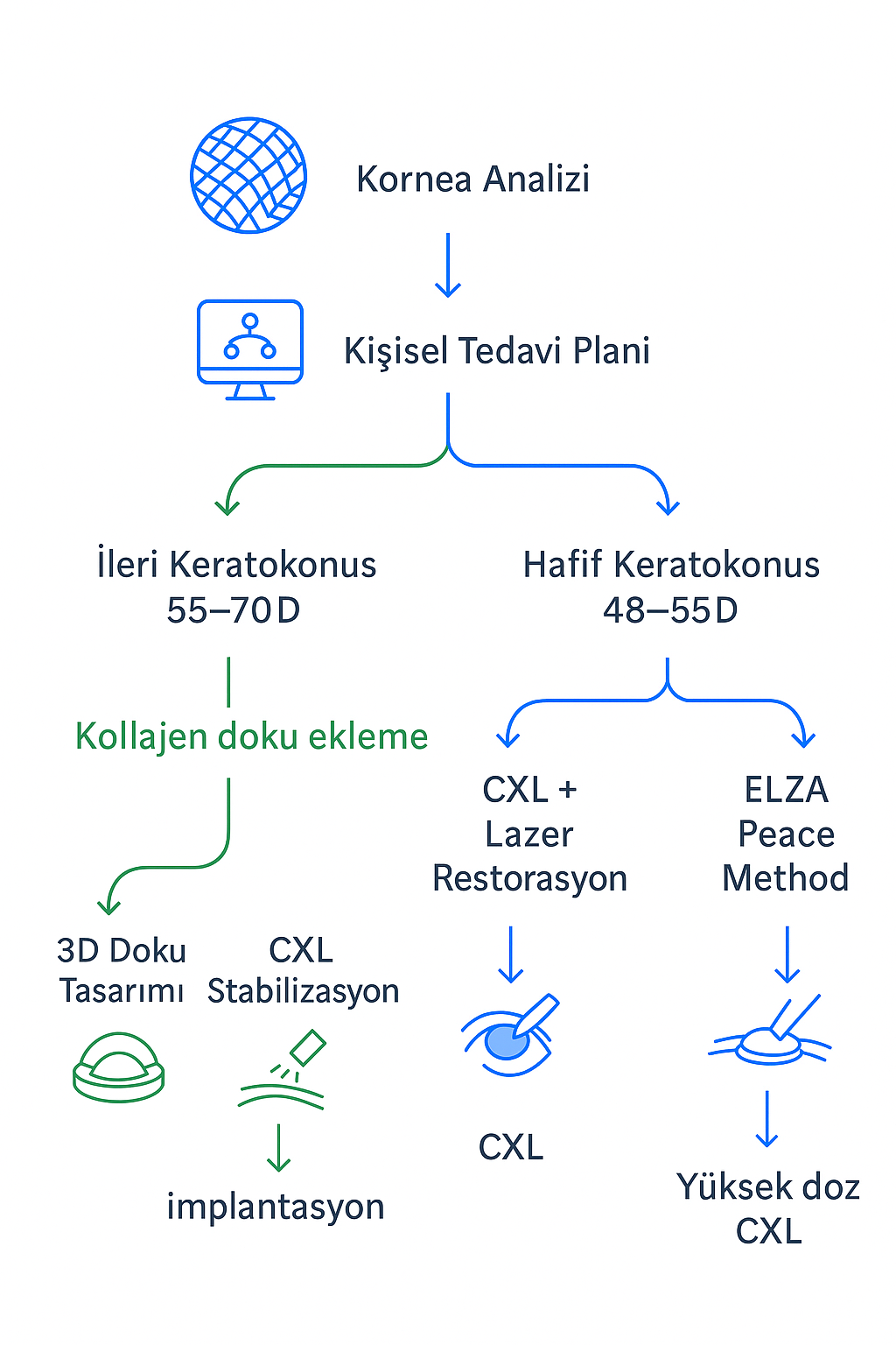 Keratokonus tedavi planı